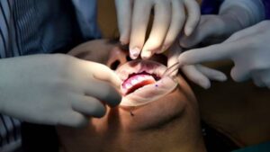 How to Choose the Right Dentist at Swansea Dental