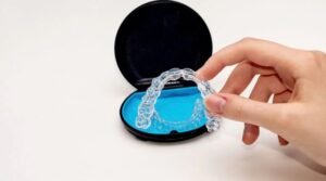 How to Protect Your Night Guard From Cracks