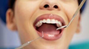 Compare The Leading Nationwide FEDVIP Dental Plans