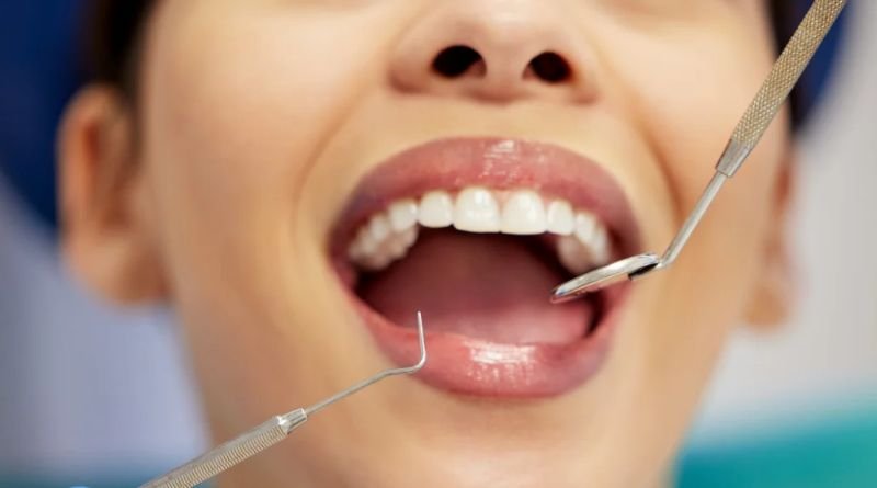 Compare The Leading Nationwide FEDVIP Dental Plans